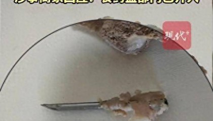 北京一男子在超市购买的排骨中吃出注射针头，涉事商家回应：食药监部门已介入