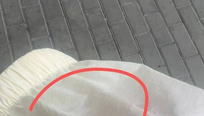 事发大连！天降痰液落在女子身上，她当场报警！此前同一地点……