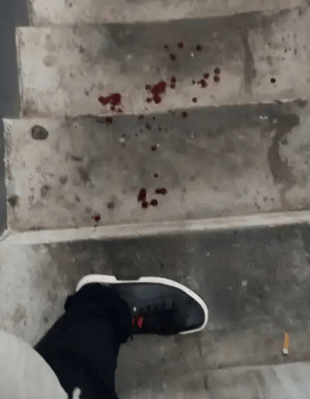 评论丨“我家狗不咬人”引发流血冲突，“犬患”背后首先是管好人