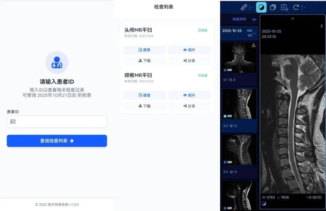 【重要通知】北部战区总医院放射诊断科“云胶片”服务全面开通!