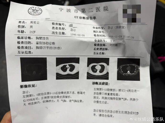 突发！知名音乐人摔下舞台，断了6根肋骨！